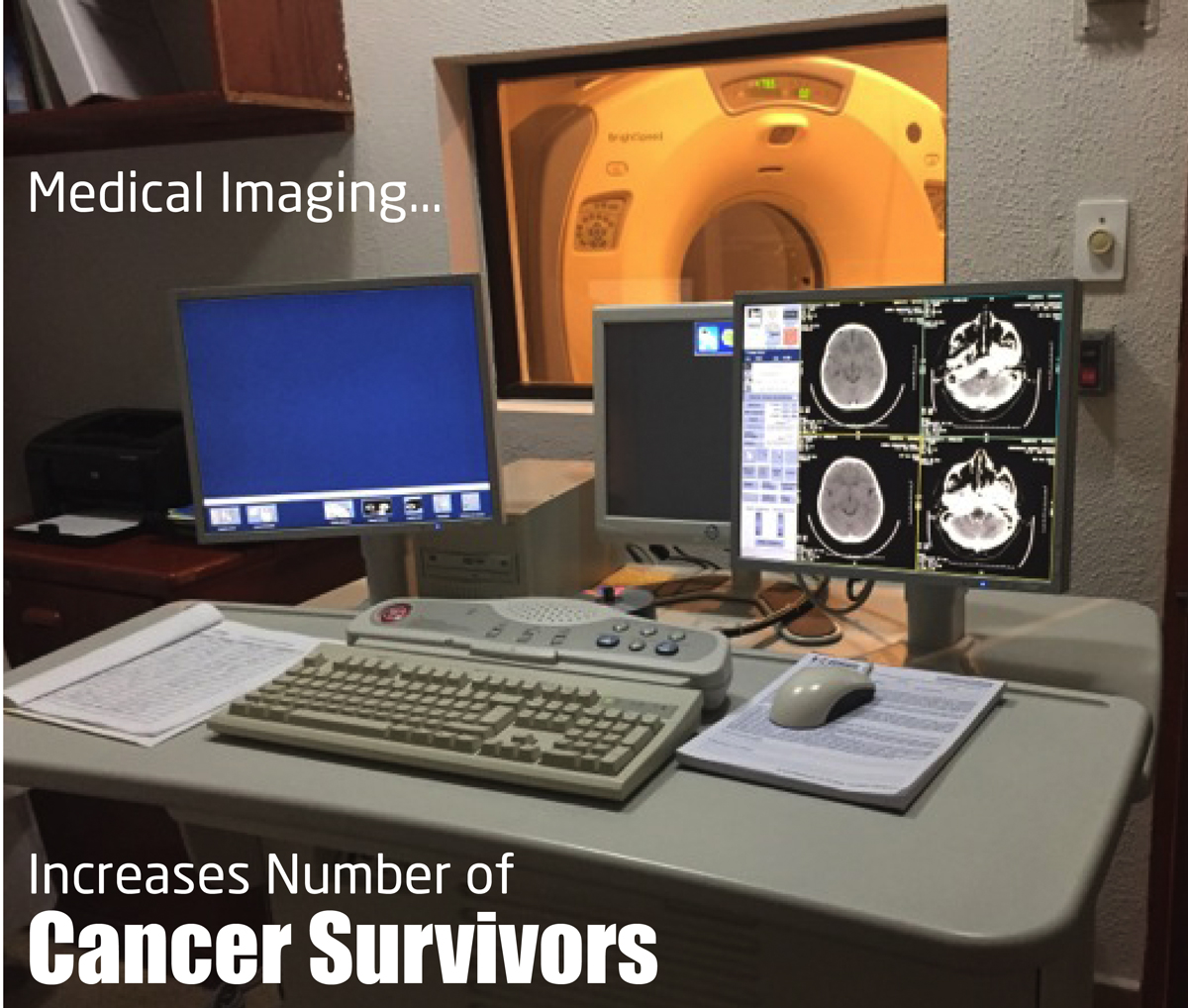 Medical Imaging Increases Number of Cancer Survivors